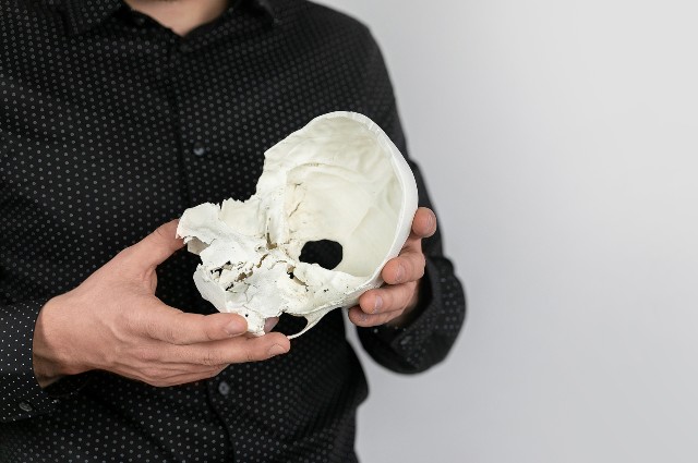 Anatomical model of the skull 3D printed with ABS material on 3DGence INDUSTRY F340 holding by a surgeon.